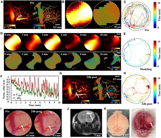 腦栓塞模型的體內驗證