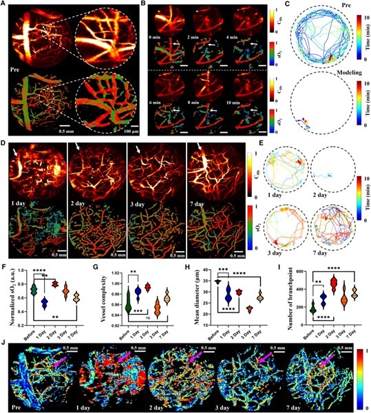嚴重區域性栓塞模型及恢復過程監測