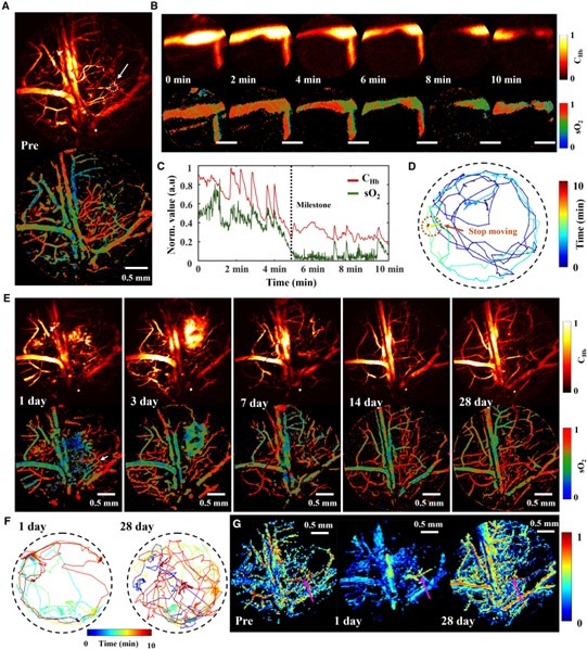 輕度可恢復栓塞模型